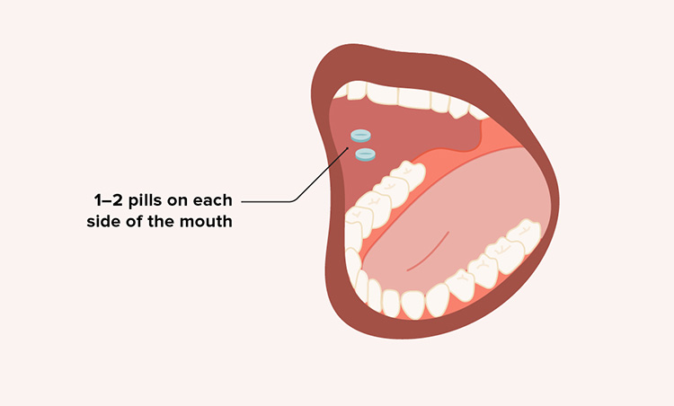 Buccal