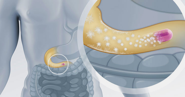 Gastric Response