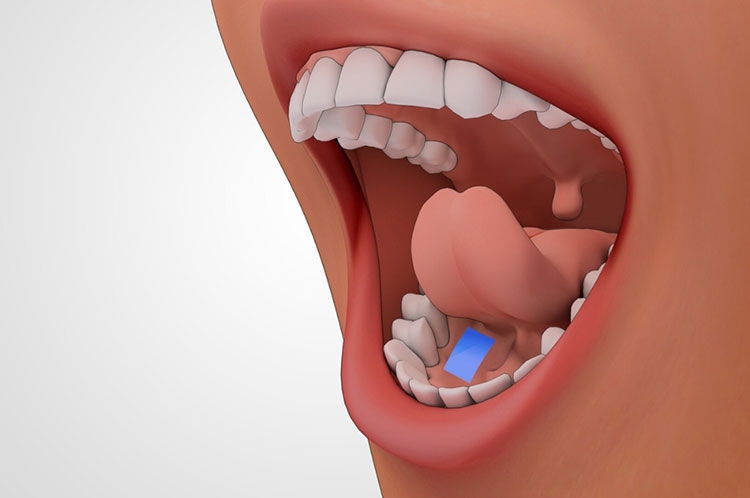 Sublingual tablets